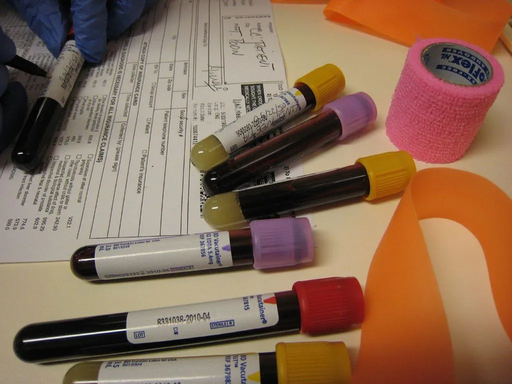 blood test laboratory technician